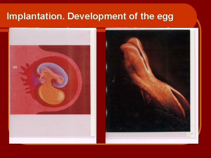 Implantation. Development of the egg 