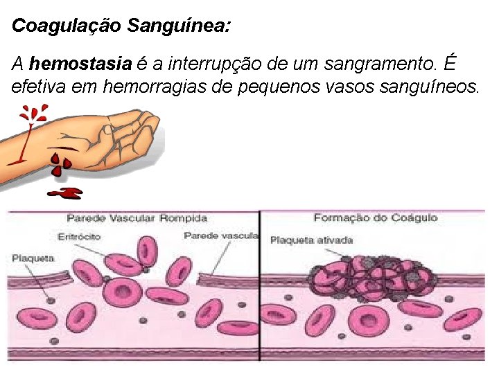 Coagulação Sanguínea: A hemostasia é a interrupção de um sangramento. É efetiva em hemorragias