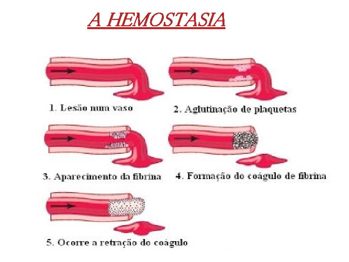 A HEMOSTASIA 