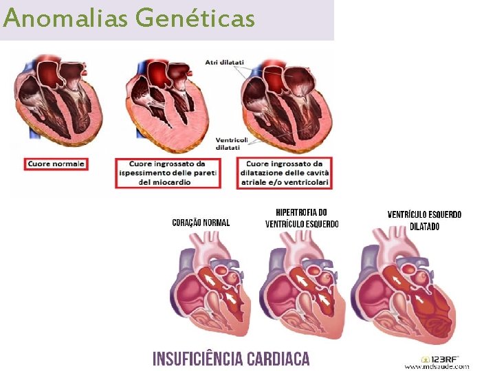 Anomalias Genéticas 