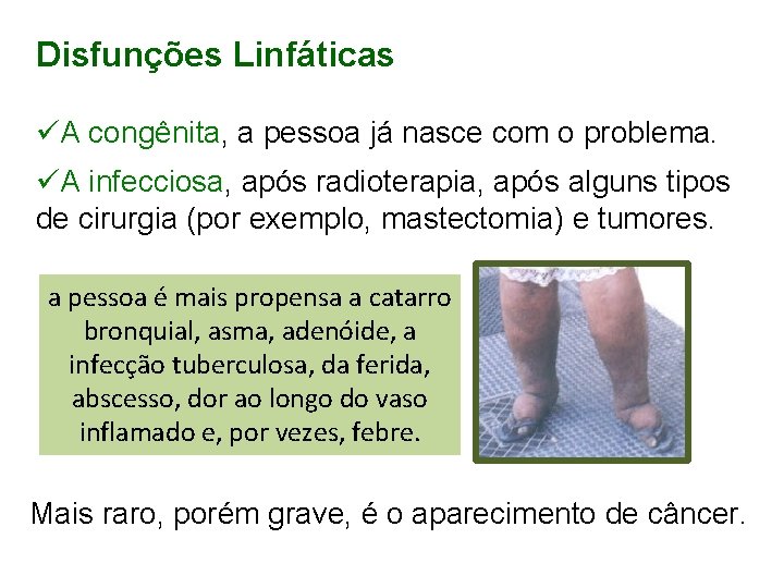 Disfunções Linfáticas üA congênita, a pessoa já nasce com o problema. üA infecciosa, após