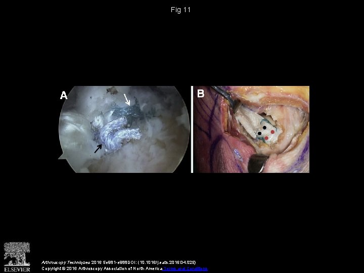 Fig 11 Arthroscopy Techniques 2016 5 e 981 -e 988 DOI: (10. 1016/j. eats.