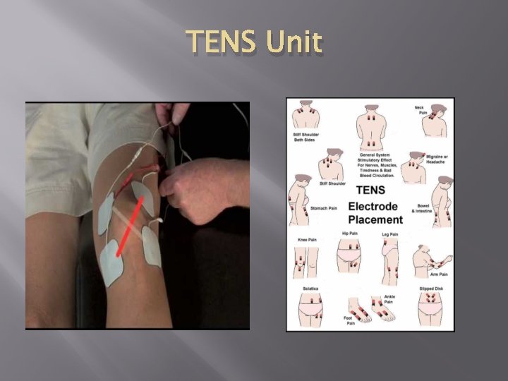 TENS Unit 