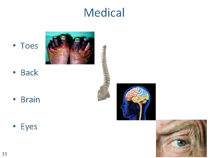 Medical • Toes • Back • Brain • Eyes 11 