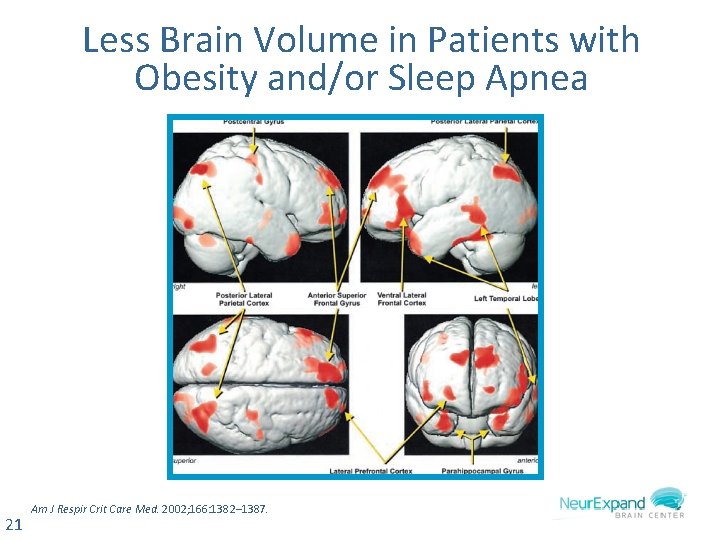 Less Brain Volume in Patients with Obesity and/or Sleep Apnea 21 Am J Respir