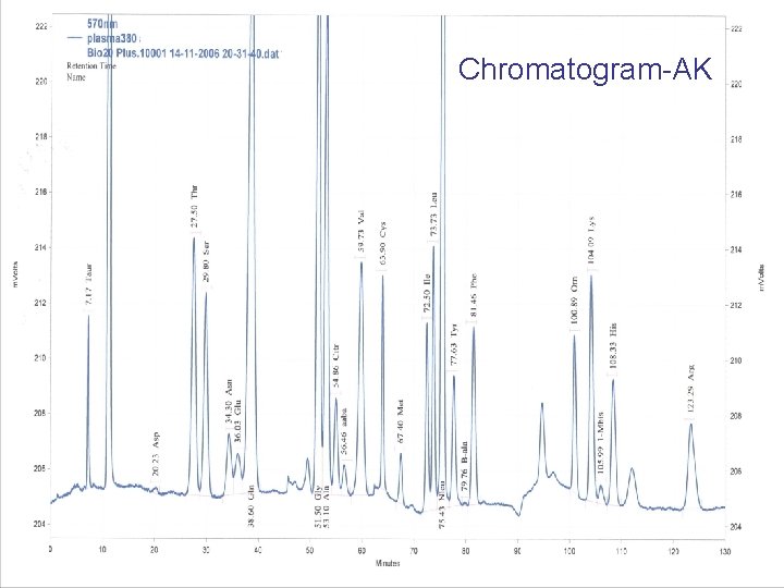Chromatogram-AK 