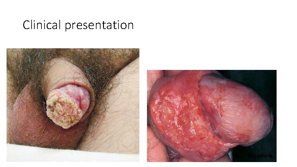 Clinical presentation 