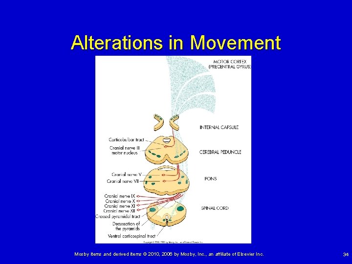 Alterations in Movement Mosby items and derived items © 2010, 2006 by Mosby, Inc.