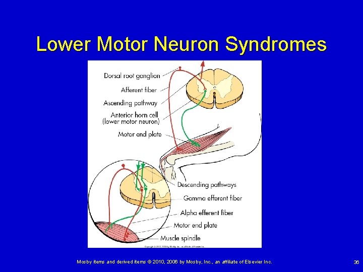 Lower Motor Neuron Syndromes Mosby items and derived items © 2010, 2006 by Mosby,