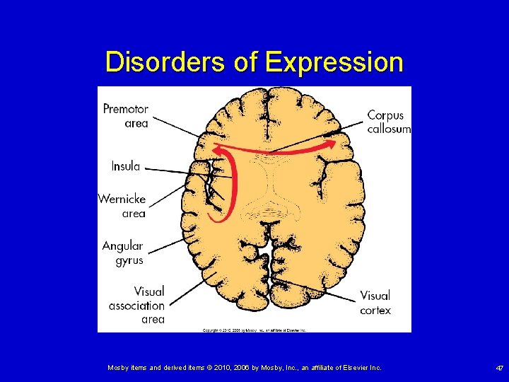 Disorders of Expression Mosby items and derived items © 2010, 2006 by Mosby, Inc.