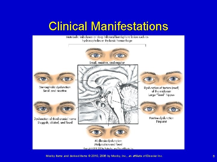 Clinical Manifestations Mosby items and derived items © 2010, 2006 by Mosby, Inc. ,