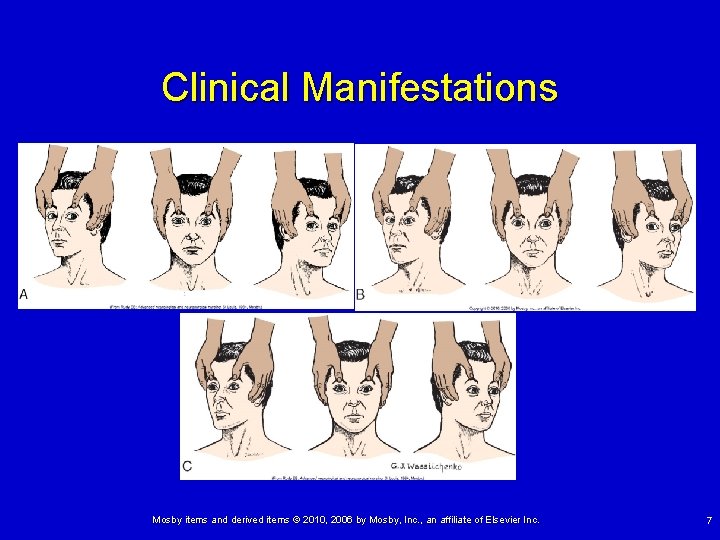 Clinical Manifestations Mosby items and derived items © 2010, 2006 by Mosby, Inc. ,