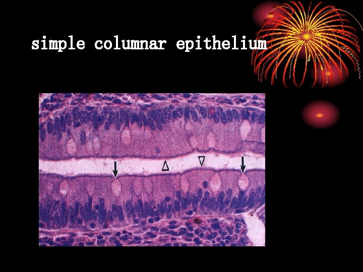 simple columnar epithelium 