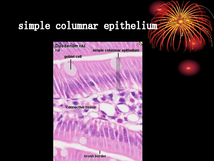 simple columnar epithelium 