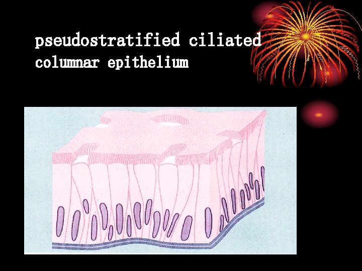 pseudostratified ciliated columnar epithelium 