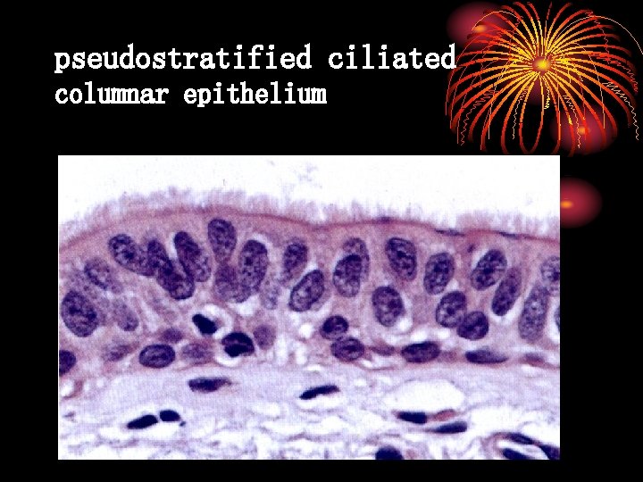 pseudostratified ciliated columnar epithelium 