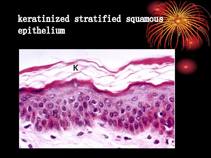 keratinized stratified squamous epithelium 