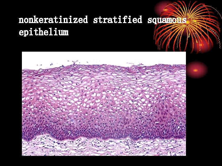 nonkeratinized stratified squamous epithelium 