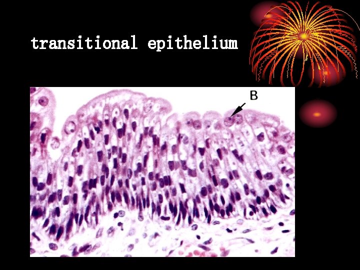 transitional epithelium 