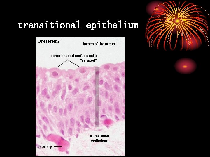transitional epithelium 