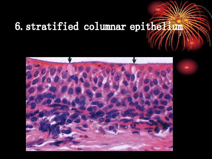 6. stratified columnar epithelium 