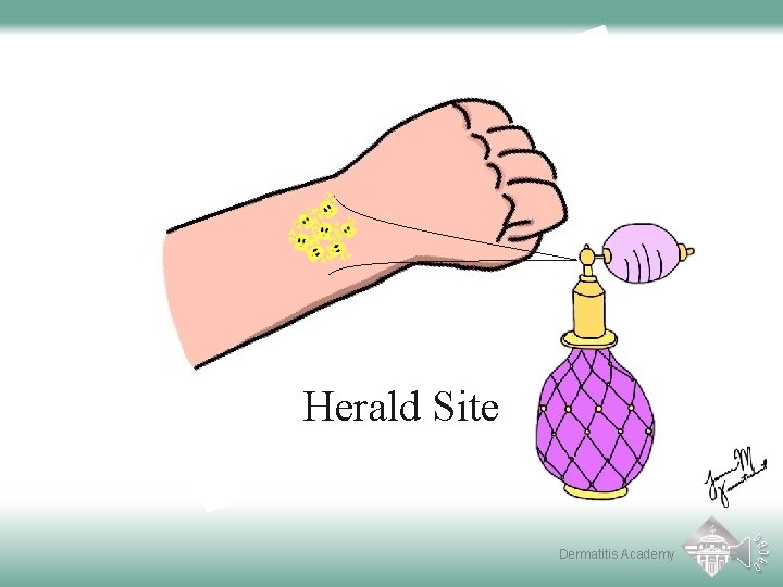 Herald Site Dermatitis Academy 