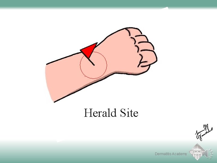 Herald Site Dermatitis Academy 