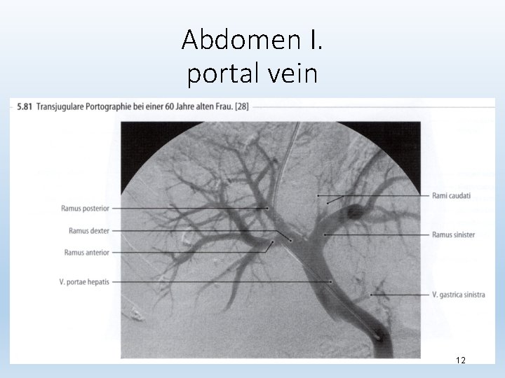 Abdomen I. portal vein 12 