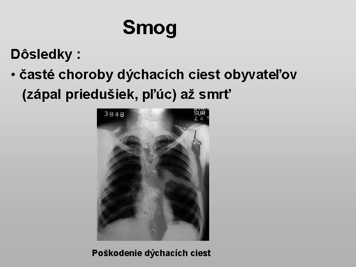 Smog Dôsledky : • časté choroby dýchacích ciest obyvateľov (zápal priedušiek, pľúc) až smrť