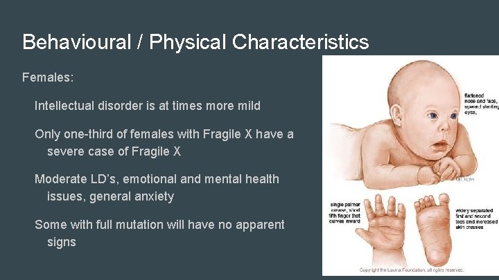 Behavioural / Physical Characteristics Females: Intellectual disorder is at times more mild Only one-third