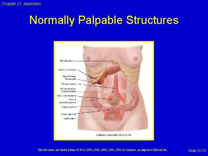 Chapter 21: Abdomen Normally Palpable Structures Elsevier items and derived items © 2012, 2008,