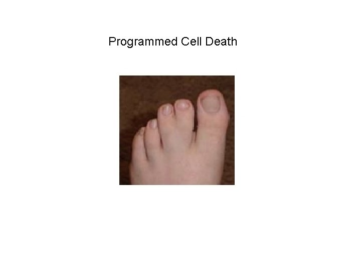 Programmed Cell Death 