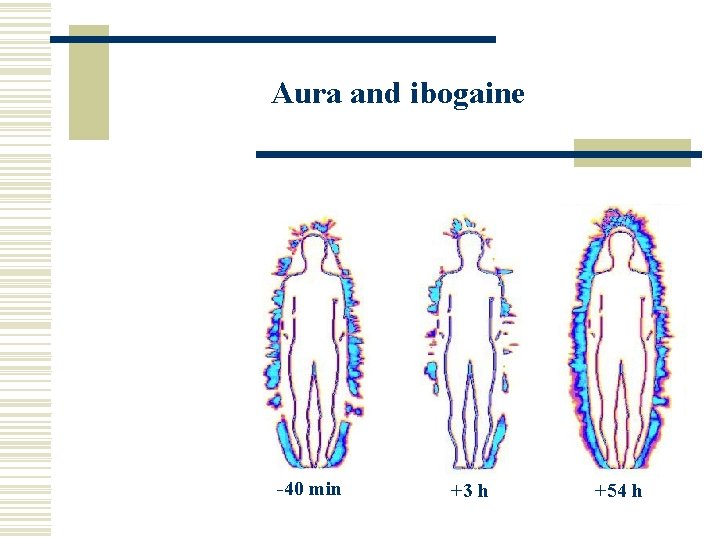 Aura and ibogaine -40 min +3 h +54 h 