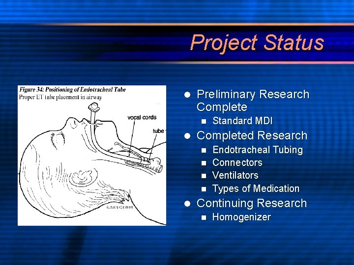 Project Status l Preliminary Research Complete n l Standard MDI Completed Research Endotracheal Tubing