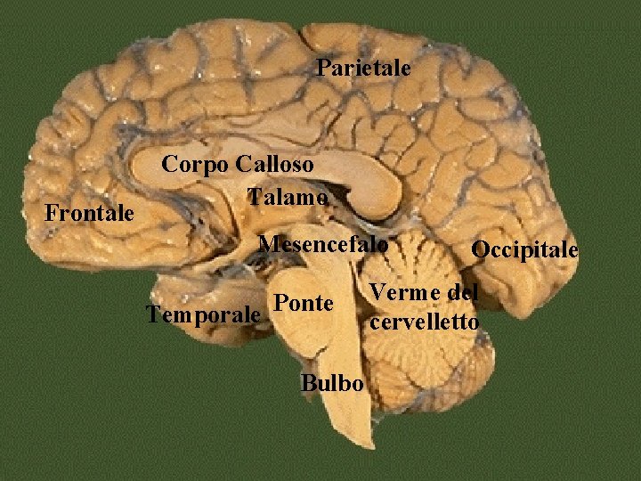 Parietale Frontale Corpo Calloso Talamo Mesencefalo Temporale Ponte Bulbo Occipitale Verme del cervelletto 