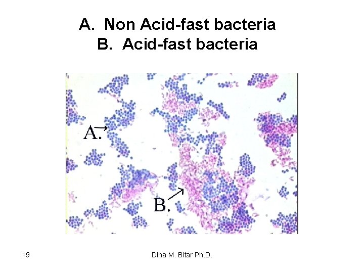 A. Non Acid-fast bacteria B. Acid-fast bacteria 19 Dina M. Bitar Ph. D. 