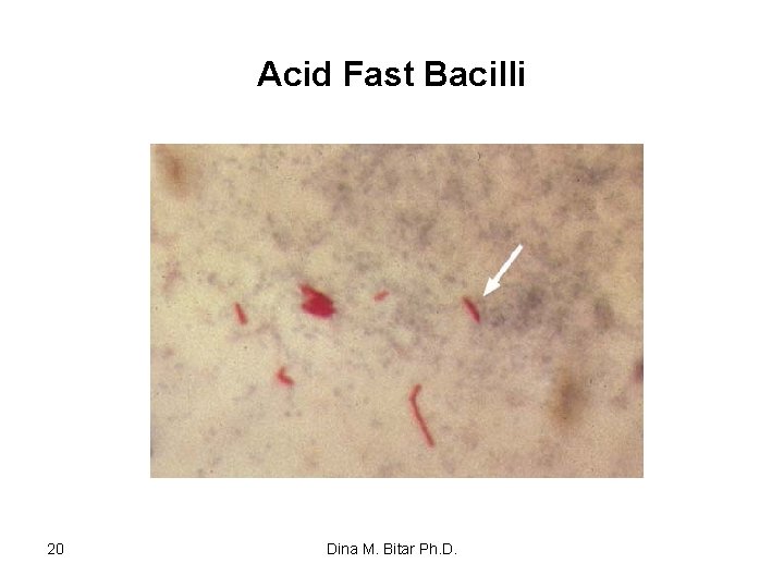 Acid Fast Bacilli 20 Dina M. Bitar Ph. D. 