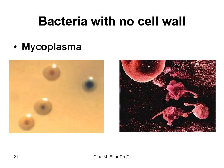 Bacteria with no cell wall • Mycoplasma 21 Dina M. Bitar Ph. D. 