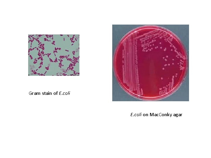 Gram stain of E. coli on Mac. Conky agar 