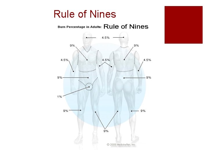 Rule of Nines 