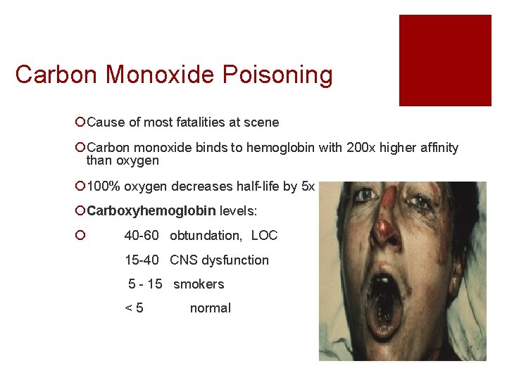 Carbon Monoxide Poisoning ¡ Cause of most fatalities at scene ¡ Carbon monoxide binds