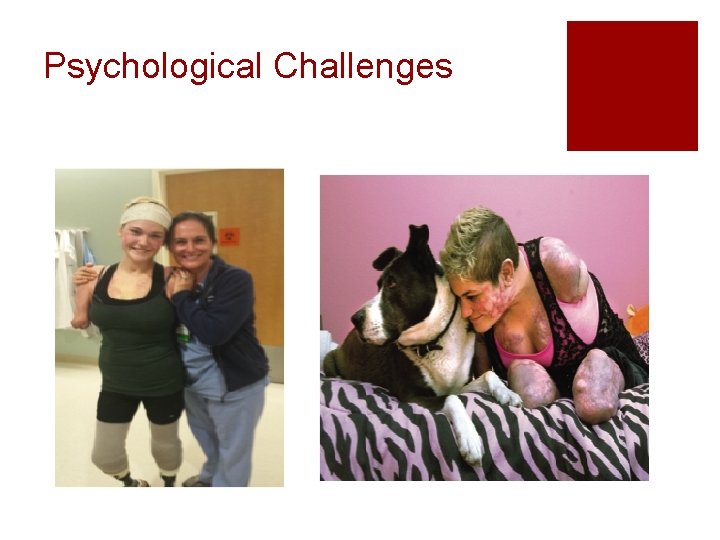 Psychological Challenges 