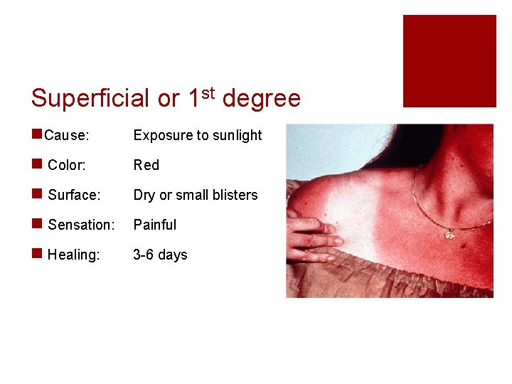Superficial or 1 st degree n. Cause: Exposure to sunlight n Color: Red n