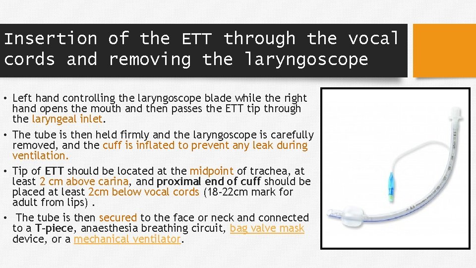 Insertion of the ETT through the vocal cords and removing the laryngoscope • Left