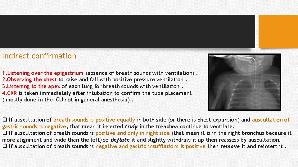 Indirect confirmation 1. Listening over the epigastrium (absence of breath sounds with ventilation). 2.