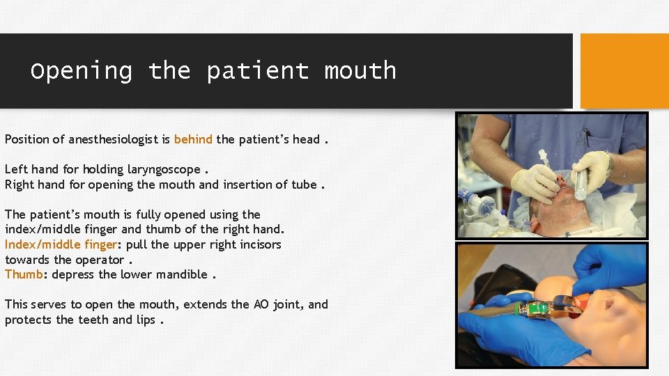 Opening the patient mouth Position of anesthesiologist is behind the patient’s head. Left hand