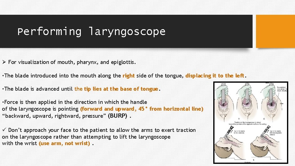 Performing laryngoscope Ø For visualization of mouth, pharynx, and epiglottis. • The blade introduced
