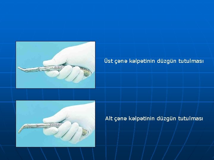 Üst çənə kəlpətinin düzgün tutulması Alt çənə kəlpətinin düzgün tutulması 