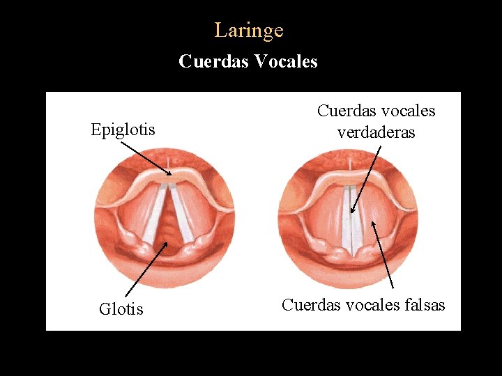 Laringe Cuerdas Vocales Epiglotis Glotis Cuerdas vocales verdaderas Cuerdas vocales falsas 