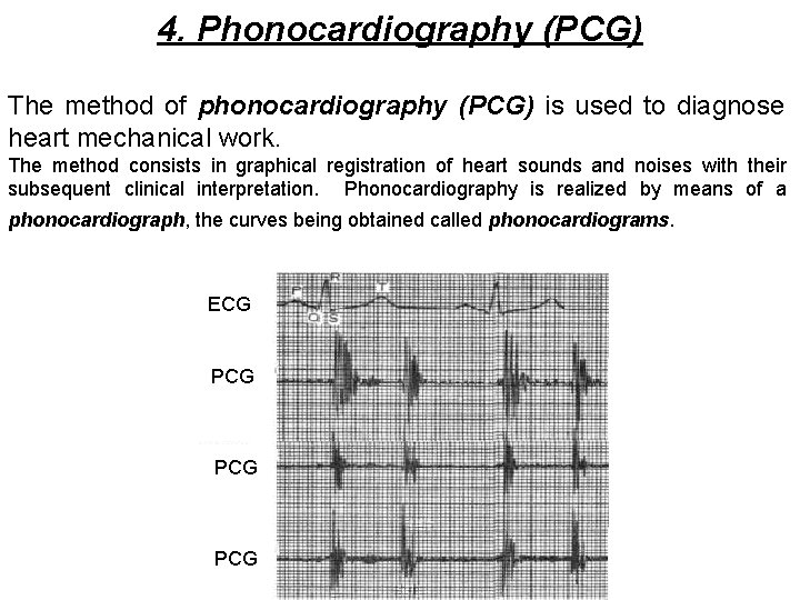 4. Phonocardiography (PCG) The method of phonocardiography (PCG) is used to diagnose heart mechanical
